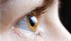 چرا قوز قرنیه در ایران شیوع بیشتری دارد؟